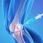 stem cell therapy in Dubai